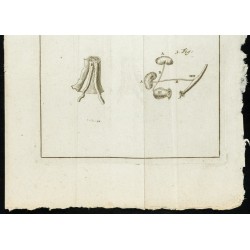 Gravure de 1777 - Hernie ombilicale Exomphale - 3