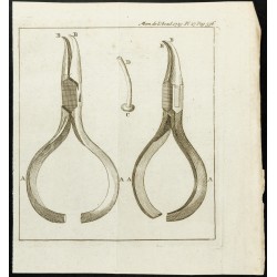 Gravure de 1777 - Instruments pour fistules lacrymales - 1