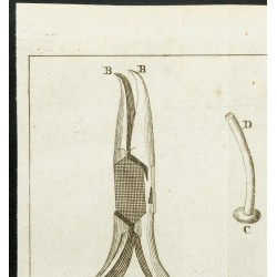 Gravure de 1777 - Instruments pour fistules lacrymales - 2