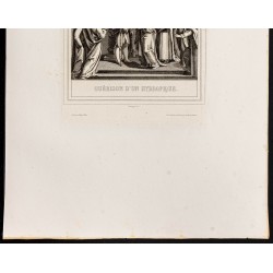 Gravure de 1853 - Guérison d'un hydropique - 4