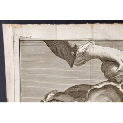 Gravure de 1781 - Chirurgie de l'abdomen - 2