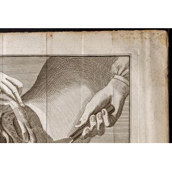 Gravure de 1781 - Chirurgie de l'abdomen - 3