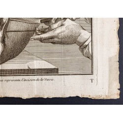 Gravure de 1781 - Chirurgie de la vessie - 5