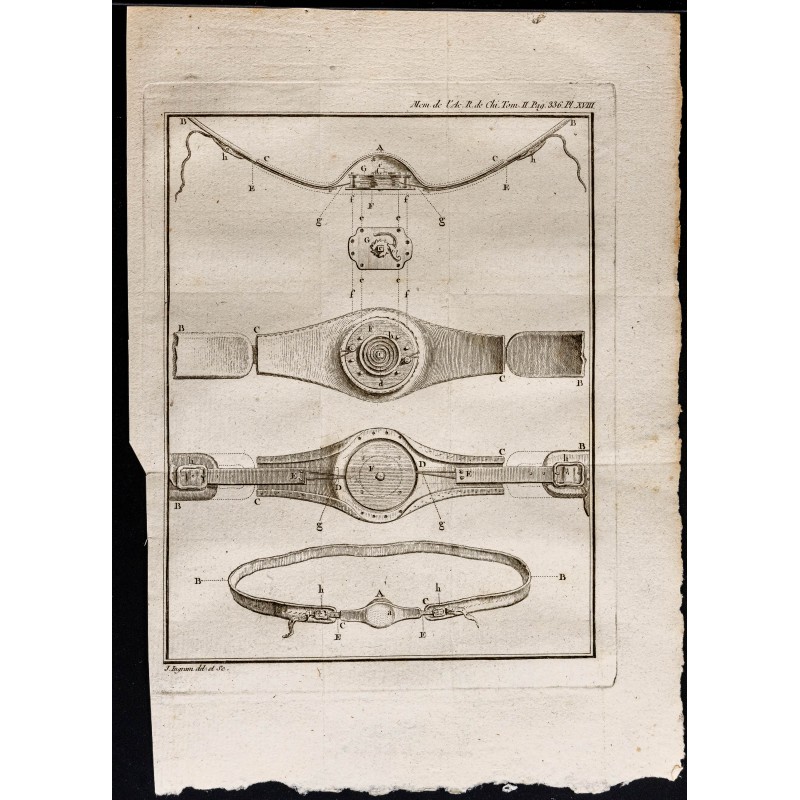 Gravure de 1787 - Ceinture pour hernie ombilicale - 1