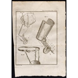 Gravure de 1787 - Machine à amputation de cuisse - 1
