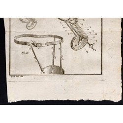 Gravure de 1787 - Machine à amputation de cuisse - 3
