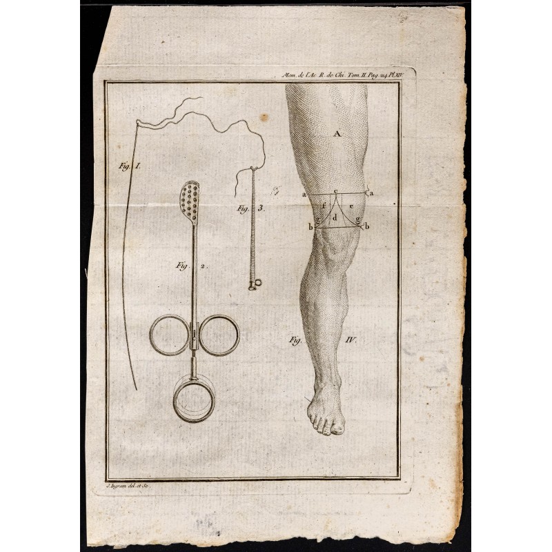 Gravure de 1787 - Instruments chirurgie - 1