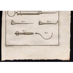 Gravure de 1787 - Instruments chirurgicaux - 3