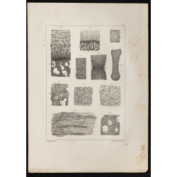 Gravure de 1864 - Tissu osseux et cartilage - 1