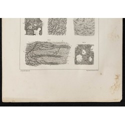 Gravure de 1864 - Tissu osseux et cartilage - 3