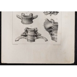 Gravure de 1864 - Nombreuses Vertèbres - 3