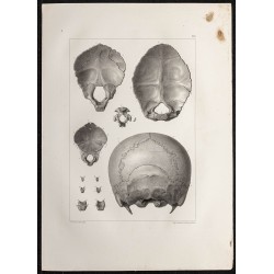 Gravure de 1864 - Os occipital - 1