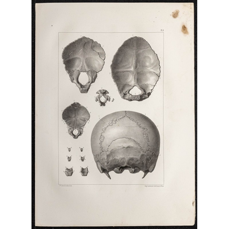 Gravure de 1864 - Os occipital - 1