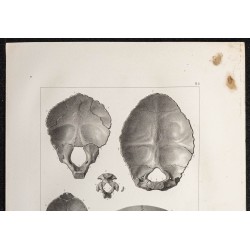 Gravure de 1864 - Os occipital - 2