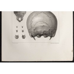 Gravure de 1864 - Os occipital - 3