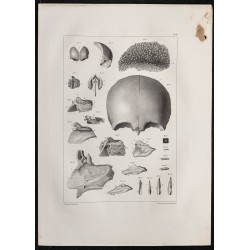 Gravure de 1864 - Os ethmoïde et crane - 1