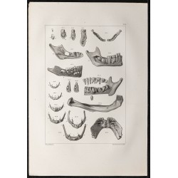 Gravure de 1864 - Crâne et mâchoire - 1