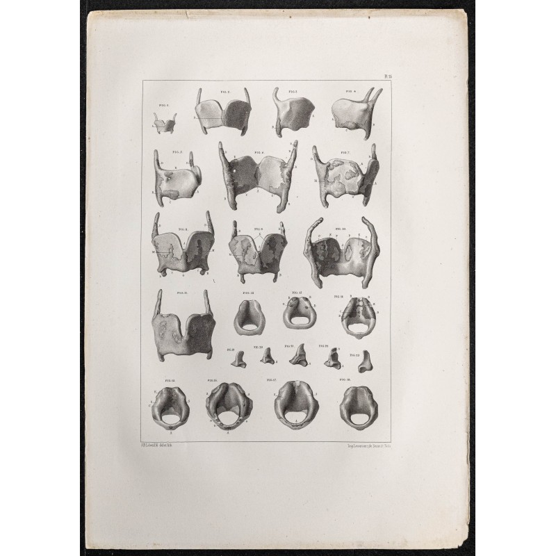 Gravure de 1864 - Cartilage Larynx et thyroïde - 1