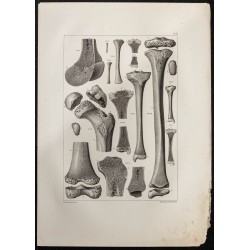 Gravure de 1864 - Os du tibia - 1