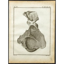 Gravure de 1764 - Estomac de la gazelle corine - 1