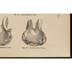 Gravure de 1882 - Mâchoires de cheval de 6 à 10 ans - 5