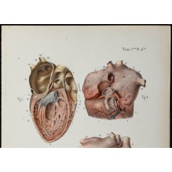 Gravure de 1866 - Angiologie & Anatomie du Coeur humain - 2