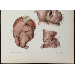 Gravure de 1866 - Angiologie & Anatomie du Coeur humain - 3