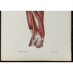 Gravure de 1866 - Angiologie & Artères du bras - 3