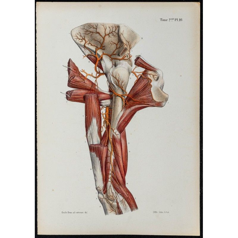 Gravure de 1866 - Angiologie & Artères du bras humain - 1