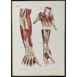 Gravure de 1866 - Artères de l'avant-bras et de la main - 1