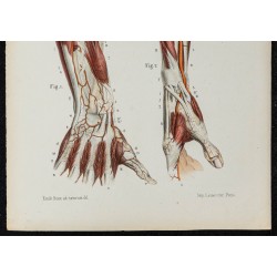 Gravure de 1866 - Artères de l'avant-bras et de la main - 3
