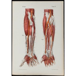 Gravure de 1866 - Artères du bras et main humaine - 1