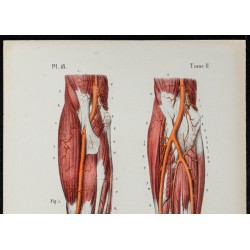 Gravure de 1866 - Artères du bras et main humaine - 2