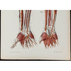 Gravure de 1866 - Artères du bras et main humaine - 3