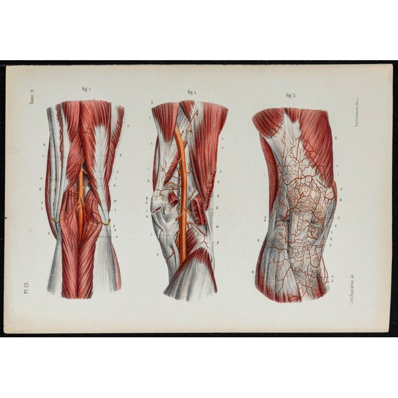 Gravure de 1866 - Angiologie & Artères du genou - 1