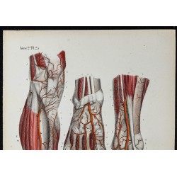 Gravure de 1866 - Artères de la jambe et du pied - 2