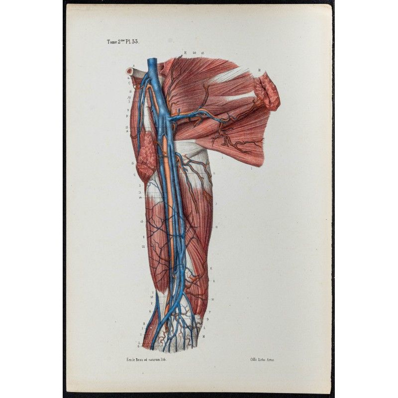 Gravure de 1866 - Angiologie - Veines du bras - 1