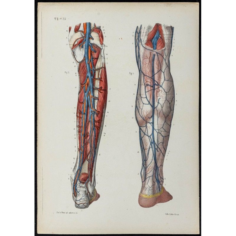 Gravure de 1866 - Angiologie - Veines de la jambe - 1