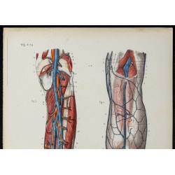 Gravure de 1866 - Angiologie - Veines de la jambe - 2