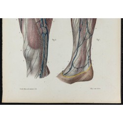 Gravure de 1866 - Vaisseaux lymphatiques du membre inférieur - 3