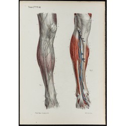 Gravure de 1866 - Vaisseaux lymphatiques de la jambe - 1