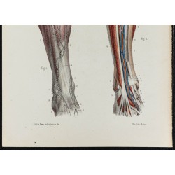 Gravure de 1866 - Vaisseaux lymphatiques de la jambe - 3