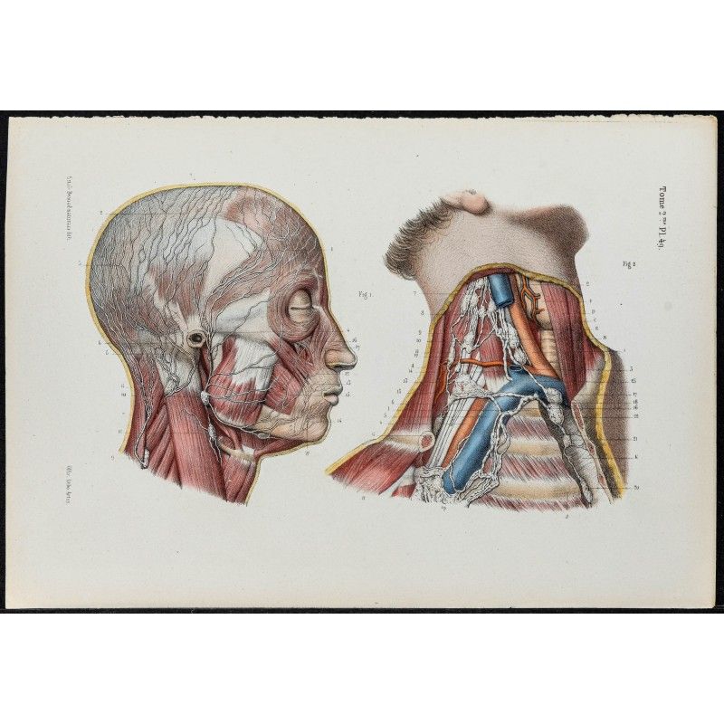 Gravure de 1866 - Vaisseaux lymphatiques de la tête et du cou - 1