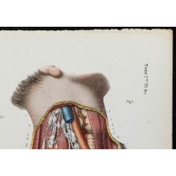 Gravure de 1866 - Vaisseaux lymphatiques de la tête et du cou - 3