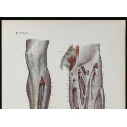 Gravure de 1866 - Aponévroses de la cuisse et de la jambe - 2