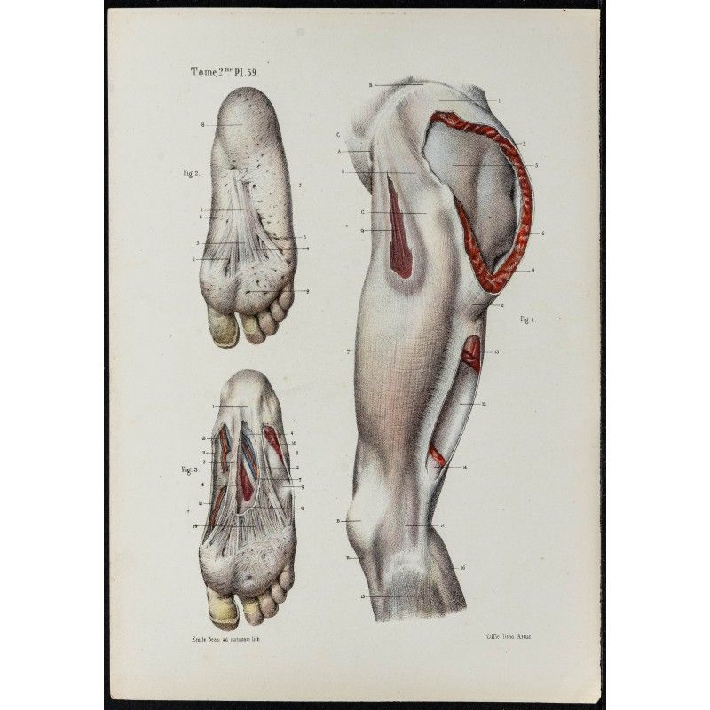 Gravure de 1866 - Aponévroses de la cuisse et du pied - 1