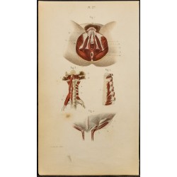 Gravure de 1846 - Muscles parties génitales féminins, sternum, cou - 1