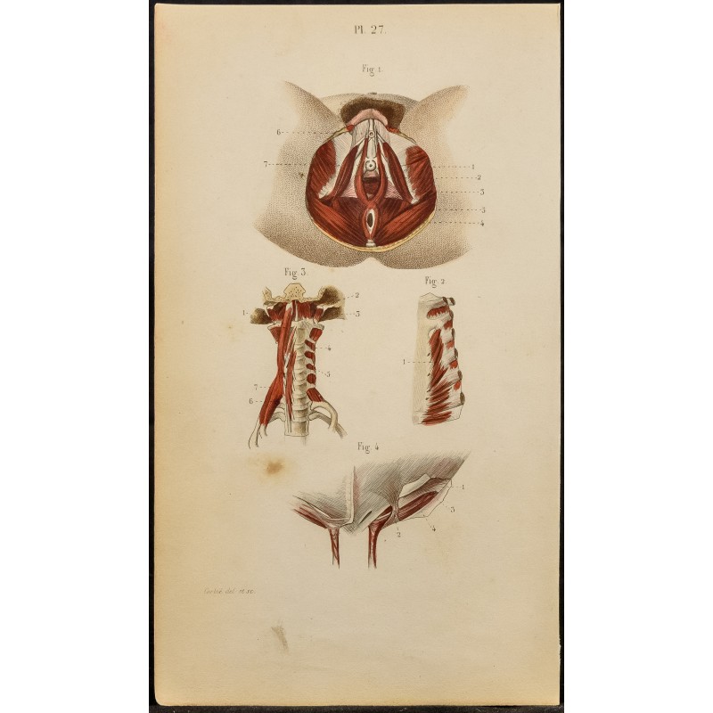 Gravure de 1846 - Muscles parties génitales féminins, sternum, cou - 1