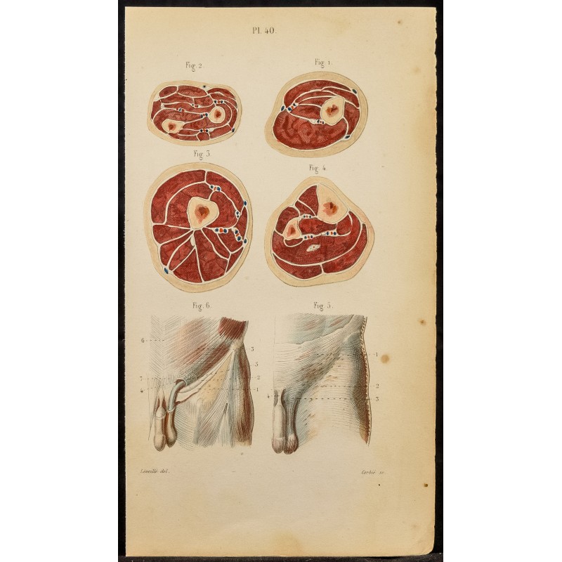 Gravure de 1846 - Coupe du bras, cuisse, jambe - 1