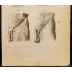 Gravure de 1846 - Coupe du bras, cuisse, jambe - 4